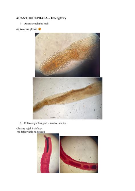  Acanthocephalus!  Parasite with a Taste for the Guts of Freshwater Fish