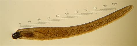  Acanthocephalus!  Parasite with a Taste for the Guts of Freshwater Fish