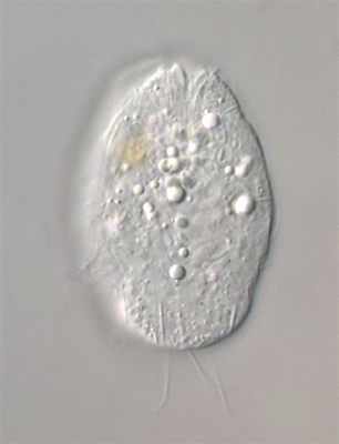  Urotricha:  The Unassuming Ciliate With a Love for Bacteria!